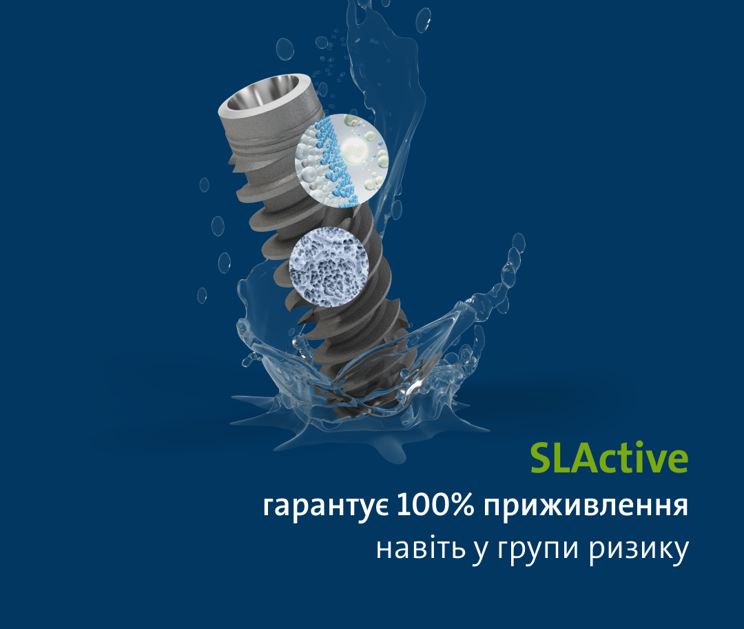 Імплантація